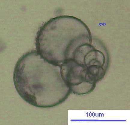 Foraminifera