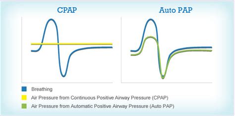 Automatic CPAP Machine and Fixed Pressure CPAP Machine Compared – Perth CPAP