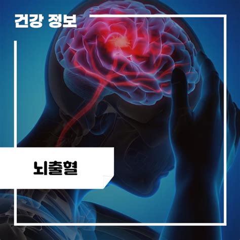 뇌출혈 전조 및 초기 증상 원인 골든타임 치료 후유증 사망 위험 네이버 블로그