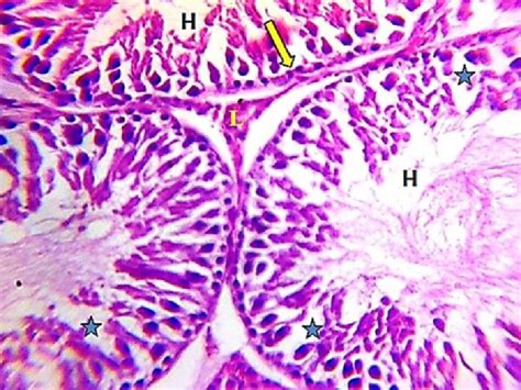 A Photomicrograph Of Adult Albino Rat S Testis G2 Showing Many S Ts