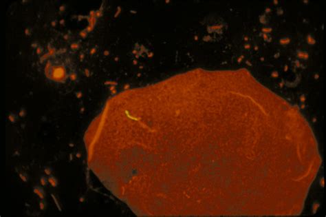 Mycobacterium Gram Stain