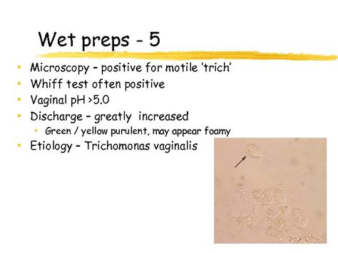 Urinalysis And Body Fluids Unit Seminal Fluid