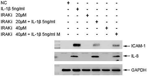 Effect Of Irak14 Inhibitor Iraki On Il 1b Induced Icam 1 And Il 8