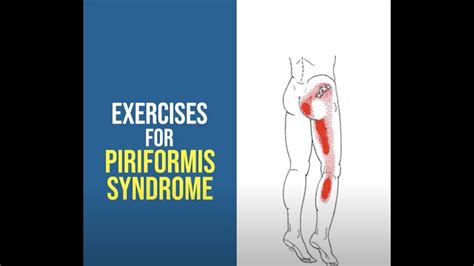 Banish The Buttock Discomfort Exercises For Piriformis Syndrome Youtube