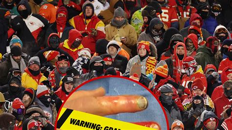 Chiefs Fans Reportedly Getting Frostbite Amputations From NFL Playoff Game