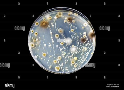 Colonies Of Different Bacteria And Mold Fungi Grown On Petri Dish With