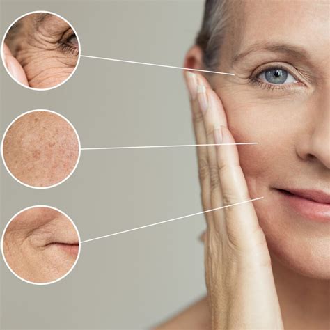 Botox For Improved Skin Tonetexture Cerulean Medical Institute