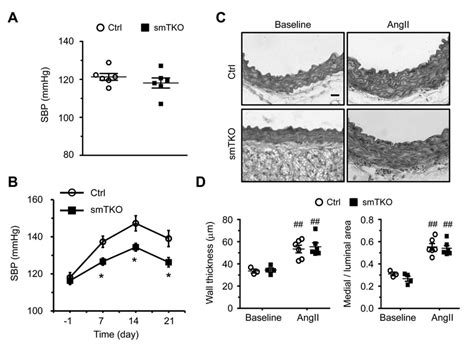 Deletion Of Ip Rs Reduced Angiotensin Ii Induced Hypertension