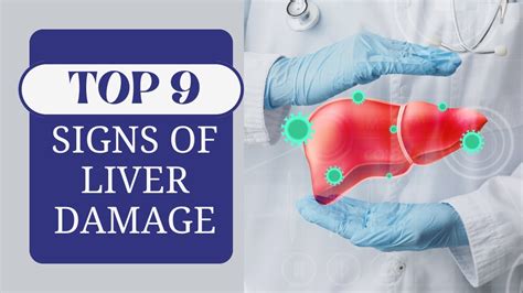 Waning Signs Of Liver Cirrhosis Top 9 Signs Of Liver Damage Early