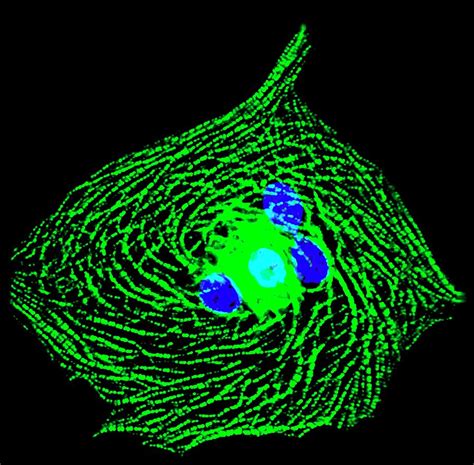 Heart Muscle Cell by R. Bick, B. Poindexter, Ut Medical School