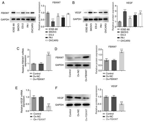 Fbxw7 Inhibits Invasion Migration And Angiogenesis In Ovarian Cancer Cells By Suppressing Vegf