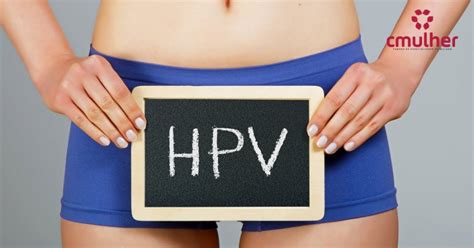 Hpv Sintomas Causas E Tratatamento Cmulher Cl Nica Especializada