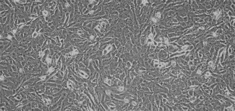 Human 143B Osteosarcoma Cells 143B CSI304Hu11 Homo Sapiens Human