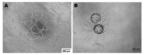 Ijms Free Full Text Endothelial Cells As Tools To Model Tissue