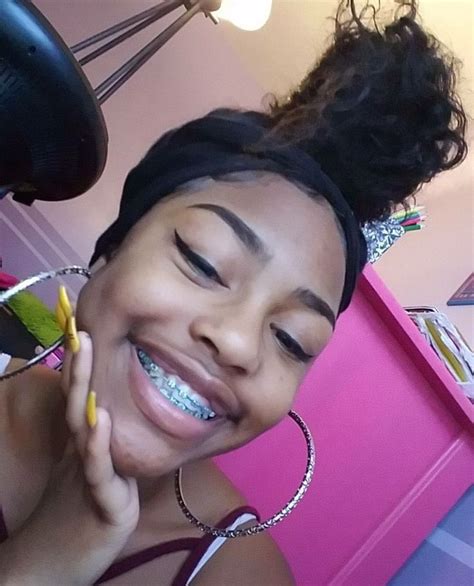 Pin On Braceface Cute Girls With Braces Cute Braces Braces Colors