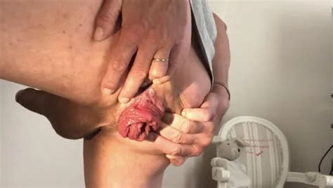 Demonstration Dilatation Anal XHamster