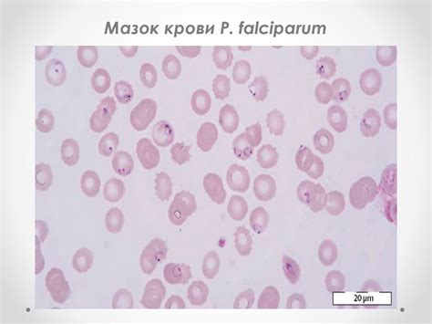 Лабораторная диагностика малярии. Лекция №6 - презентация онлайн