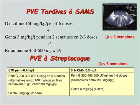 Ppt Prise En Charge D’une Endocardite Infectieuse Sur Prothese Powerpoint Presentation Id