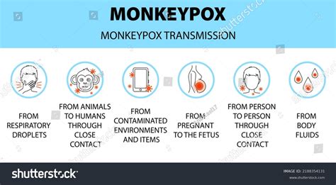 Monkeypox Virus Transmission Icons Infographic New Stock Vector ...