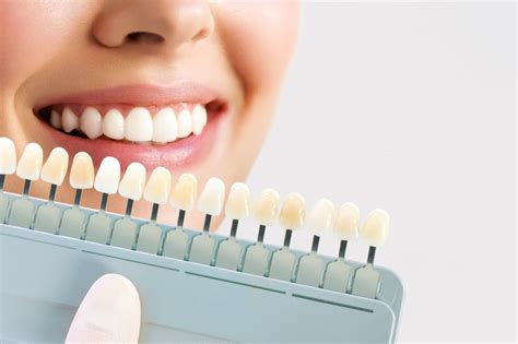 En qué consiste el blanqueamiento dental Like Dental