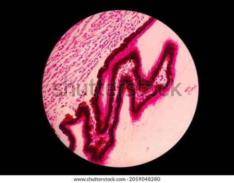 Histology Human Eye Ciliary Process 40x Stock Photo 2059048280 ...