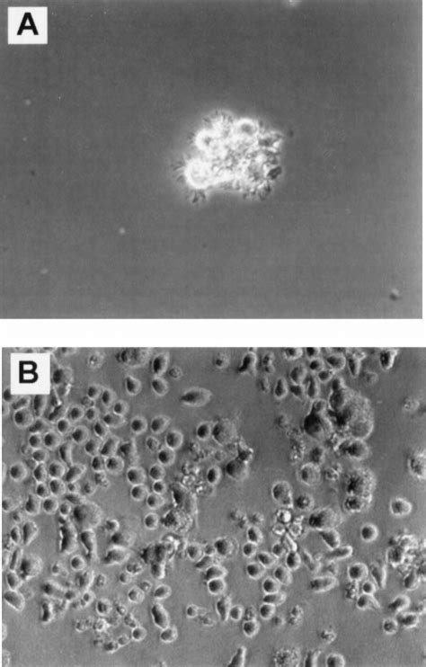 Cultures In Fkgm Phase Contrast Photomicrograph Shows Cultures