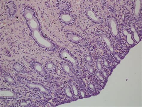 Tero Gl Ndulas Uterinas Atlas De Histologia Veterin Ria