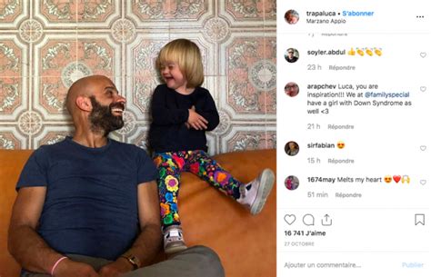 Apr S Avoir T Refus E Par Familles Une Fillette Trisomique Adopt E Par Un Papa Gay