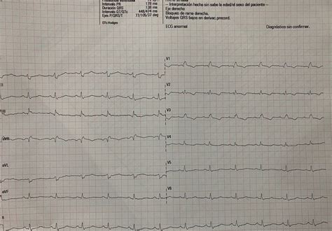 Ecgrhythms On Twitter Rt Relm Y Male Htn And Smoker W