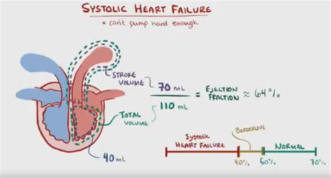 Congestive Heart Failure Acute Left Ventricular Systolic Dysfunction