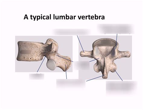 MSS Typical Lumbar Vertebra Diagram Quizlet