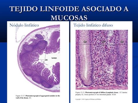 Histología De Tejido Linfoide