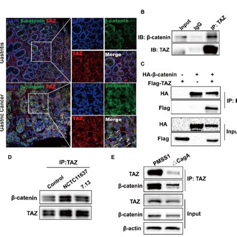 CagA H Pylori Infection Enhances The Interaction Of TAZ With