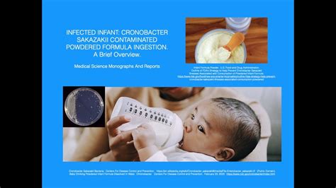 Infected Infant Cronobacter Sakazakii Contaminated Powdered Infant