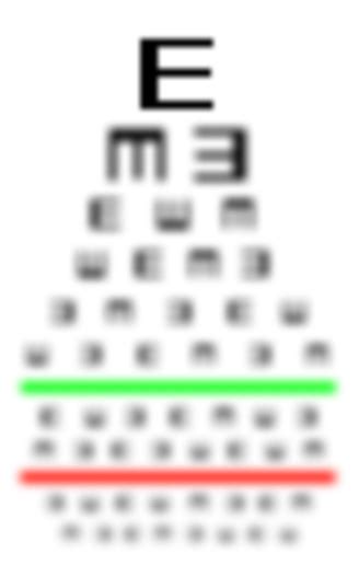 Eyesight Concept Really Bad Eyesight Stock Photo - Download Image Now ...