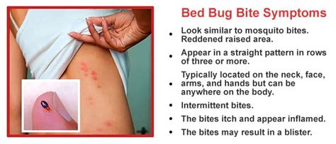 Ideas 40 of Bed Bug Bites Vs Flea Bites Pictures | assuemeevidencia