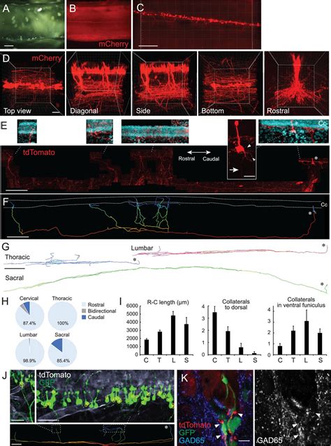 Figures And Data In Cerebrospinal Fluid Contacting Neuron Tracing