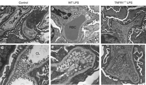 Transmission Electron Microscopic Ultrastructure Of Glomerular