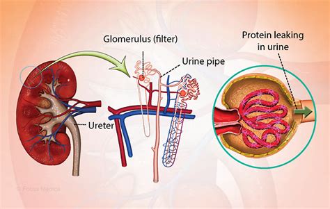 Health Condition Symptoms Causes Treatment And More