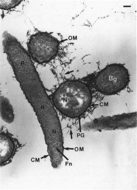 Coaggregation Between Porphyromonas Gingivalis Bg And Fusobacterium