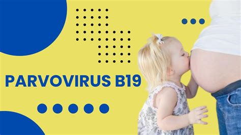 Parvovirus B19 Infection Fifth Disease Clinical Features Diagnosis