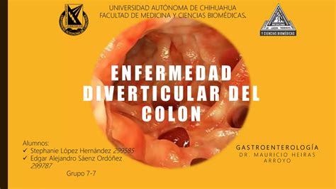 Enfermedad Diverticular Del Colon Ppt