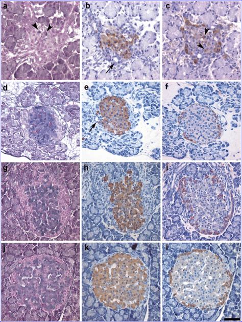 Morphology And Cytoarchitecture Of Pancreatic Islets During Rat