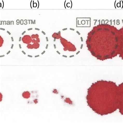 Usererrors Associated With Dried Blood Spot Dbs Sampling Examples