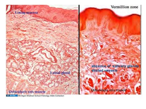 01 05 09 Histology Oral Cavity And Salivary Glands