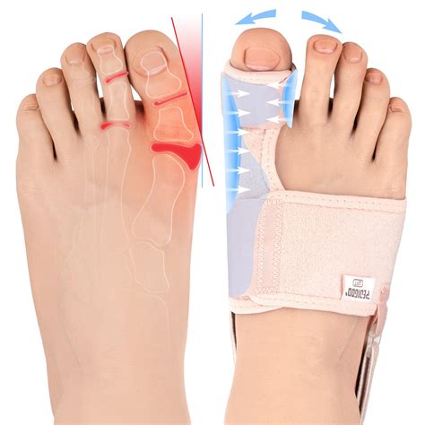 Best Bunion Corrector Top 5 Products For Pain Relief Pixelfy Blog