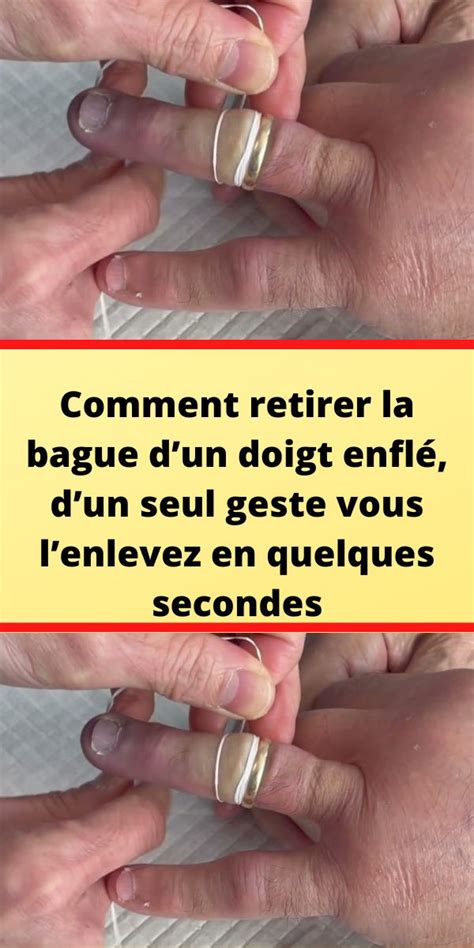 Comment Retirer La Bague Dun Doigt Enfl Dun Seul Geste Vous L