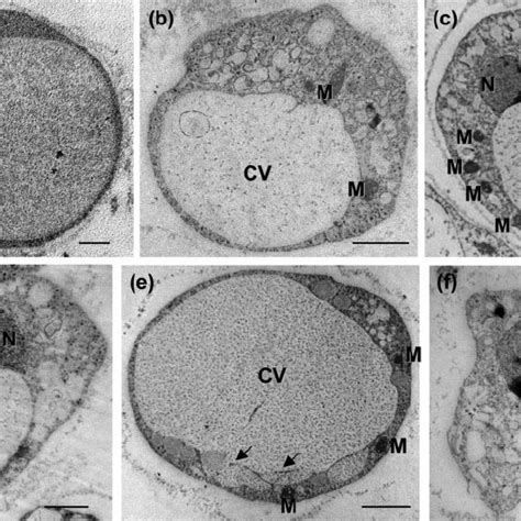 Effect of STS on Blastocystis cell size as analysed by flow cytometry ... 