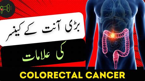 Colon Cancer Symptoms Bari Aant K Cancer Ki Alamaat Stool K Sath