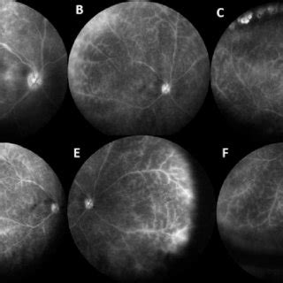 PDF Review for Diagnostics of the Year Multimodal Imaging in Behçet